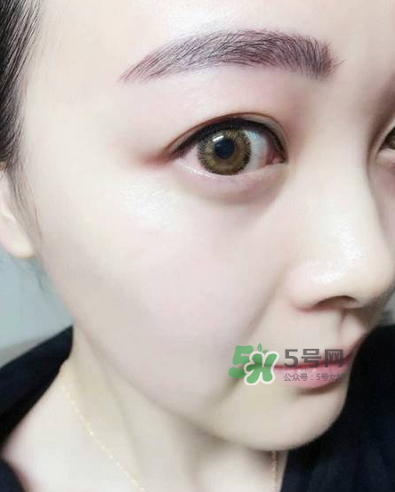 做美瞳線對眼睛有傷害嗎？做美瞳線會傷眼睛嗎？