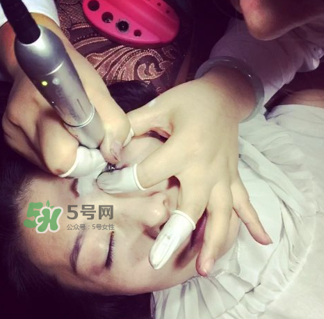 做美瞳線要打麻藥嗎？做美瞳線麻藥怎么敷？