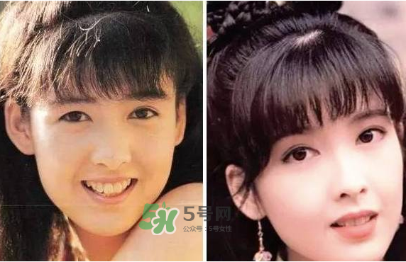 8月份可以割雙眼皮嗎？幾月份割雙眼皮最好？