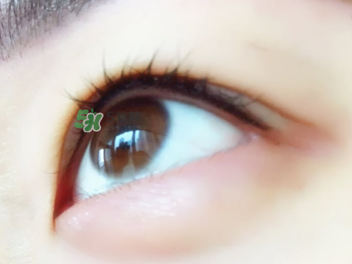 做美瞳線麻藥進眼睛怎么辦？做美瞳線麻藥灼傷眼睛怎么辦？