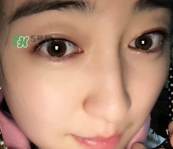 做美瞳線可以喝酒嗎？做美瞳線喝酒有影響嗎？