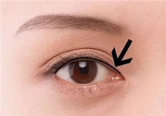 做美瞳線可以吃雞蛋嗎？做美瞳線能吃雞蛋嗎？