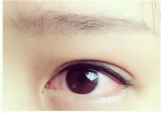 美瞳線有必要做嗎？做美瞳線多少錢(qián)？