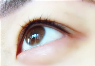 做美瞳線麻藥進(jìn)眼睛怎么辦？做美瞳線麻藥灼傷眼睛怎么辦？