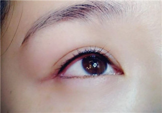 做美瞳線眼睛會(huì)腫嗎?做美瞳線眼睛腫了怎么辦?