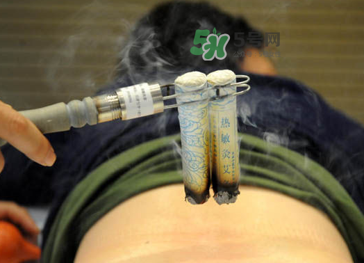 三伏天艾灸后能吹空調(diào)嗎？三伏天艾灸后能吹電扇嗎？