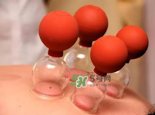 三伏天拔罐好嗎？三伏天拔罐好還是艾灸好？