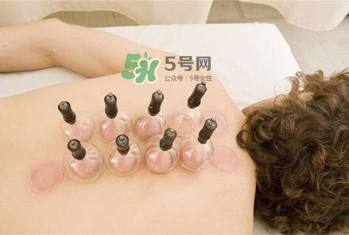 三伏天拔罐好嗎？三伏天拔罐好還是艾灸好？