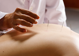 陰天下雨能針灸嗎？陰天下雨可以針灸嗎