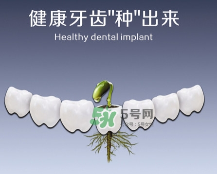 種植牙費用多少錢？國產(chǎn)種植牙價格