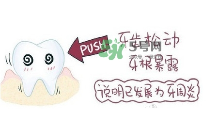 牙齒松動會自己好嗎？牙齒松動會自己掉嗎