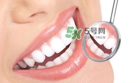 牙齒縫隙大怎么辦？牙縫大帶牙套有用嗎