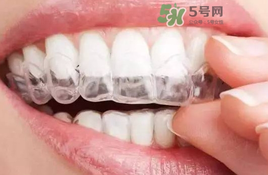 牙齒有縫隙可以補(bǔ)嗎？牙齒縫隙大能補(bǔ)嗎