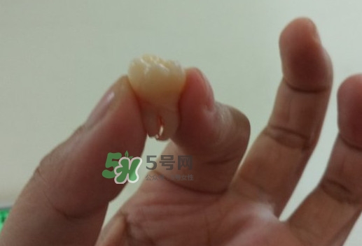 拔智齒痛嗎？智齒拔了多久洞會好？