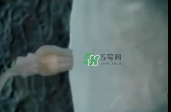 懷孕初期怎么保胎？陰道出血是流產(chǎn)征兆嗎？