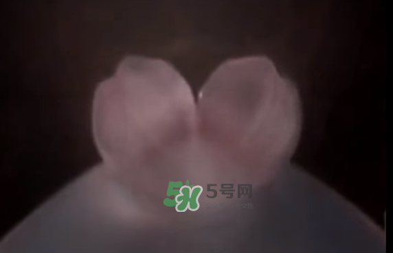 懷孕初期怎么保胎？陰道出血是流產(chǎn)征兆嗎？