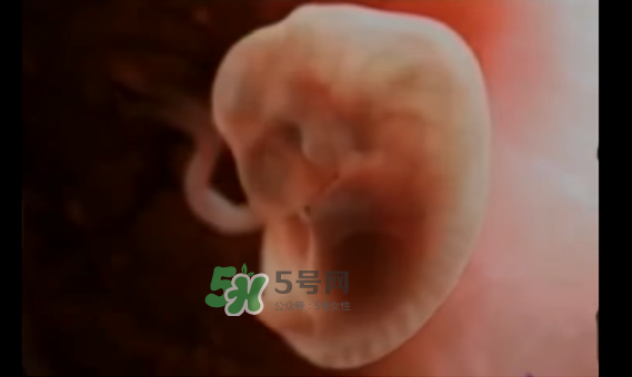 懷孕初期怎么保胎？陰道出血是流產(chǎn)征兆嗎？