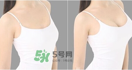 女性乳頭癢是怎么回事？女性乳頭癢要怎么治療？