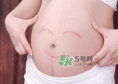 產(chǎn)婦胃脹氣怎么緩解？產(chǎn)婦胃脹氣怎么辦？