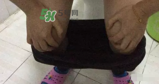 孕期可以蹲著上廁所嗎？孕期上廁所會壓到寶寶嗎？