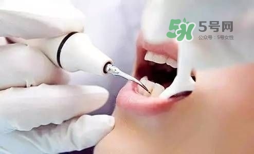 孕婦能矯正牙齒嗎？懷孕期間可以矯正牙齒嗎？