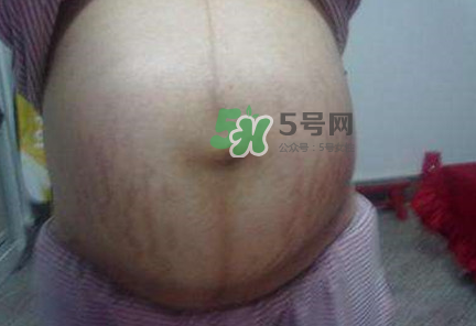 懷女孩肚子上會長毛嗎？懷女孩肚子特征圖片