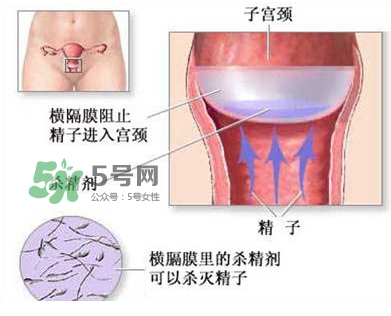 殺精劑避孕可靠嗎？殺精劑避孕要注意什么？