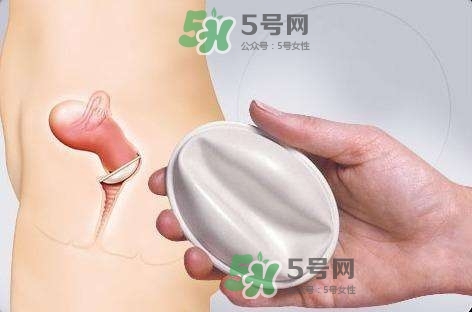 使用殺精劑避孕失敗孩子能要嗎？殺精劑避孕的不良反應(yīng)