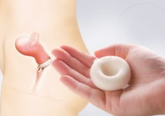 殺精劑有什么副作用？殺精劑的使用方法