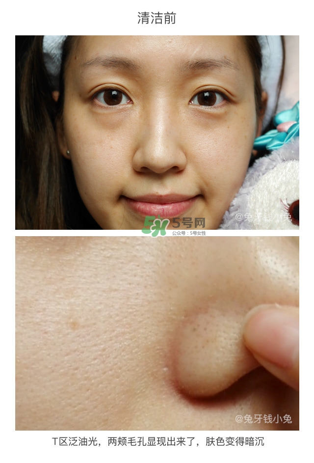 哪種護(hù)膚品可以深層清潔臉部毛孔 深層清潔的護(hù)膚品推薦 哪種護(hù)膚品可以深層清潔臉部毛孔 深層清潔的護(hù)膚品推薦