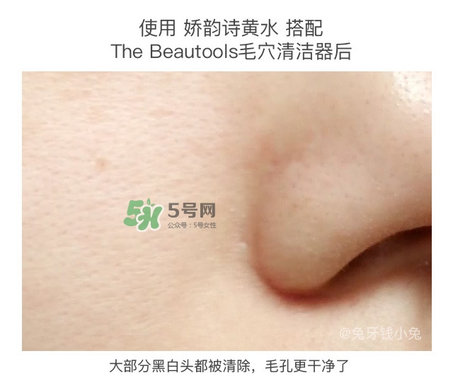 哪種護(hù)膚品可以深層清潔臉部毛孔 深層清潔的護(hù)膚品推薦 哪種護(hù)膚品可以深層清潔臉部毛孔 深層清潔的護(hù)膚品推薦