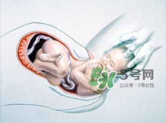 順產(chǎn)和剖腹產(chǎn)哪個好？順產(chǎn)和剖腹產(chǎn)哪個痛？