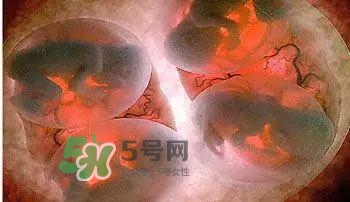 多胞胎順產(chǎn)怎么生？多胞胎剖腹產(chǎn)和單胎剖腹產(chǎn)的區(qū)別
