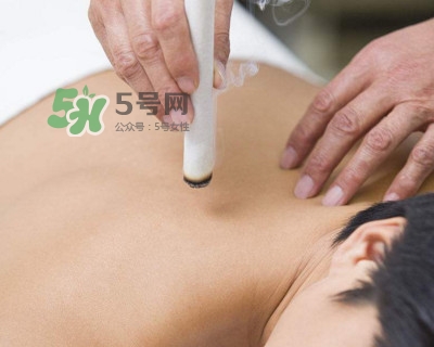 艾灸器具哪種好？艾灸后皮膚極癢為什么