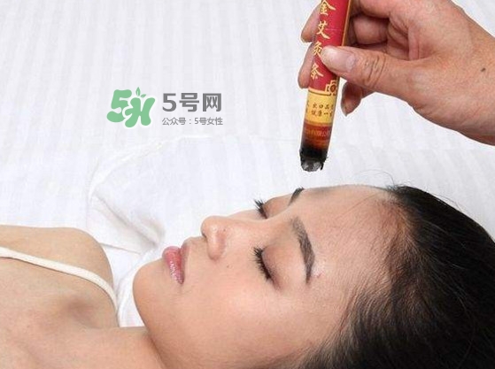 艾灸會不會過敏？艾灸過敏怎么辦