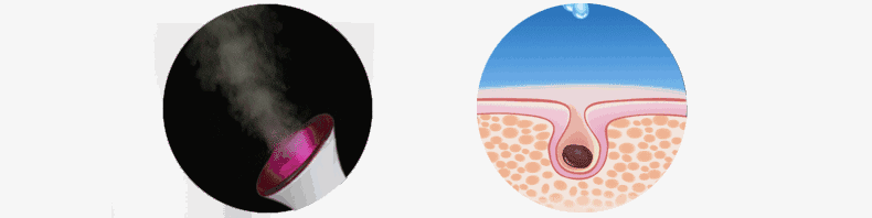 蒸臉器的最佳使用方法 蒸臉器哪個(gè)牌子好 蒸臉器的最佳使用方法 蒸臉器哪個(gè)牌子好