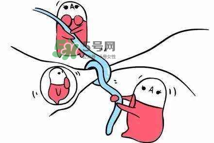 結(jié)扎好還是上環(huán)好？結(jié)扎上環(huán)哪個危害?。?></p><p style=