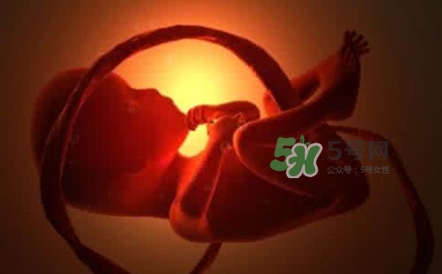 寶寶臍帶繞頸只能剖腹產(chǎn)嗎？胎兒臍帶繞頸孕婦有什么感覺(jué)