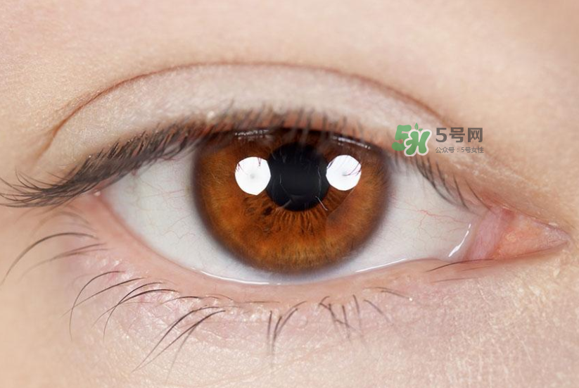 做近視手術(shù)多少錢？做近視手術(shù)的條件