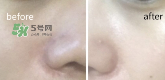 hr綠寶瓶新肌水怎么用？赫蓮娜綠寶瓶新肌水使用方法