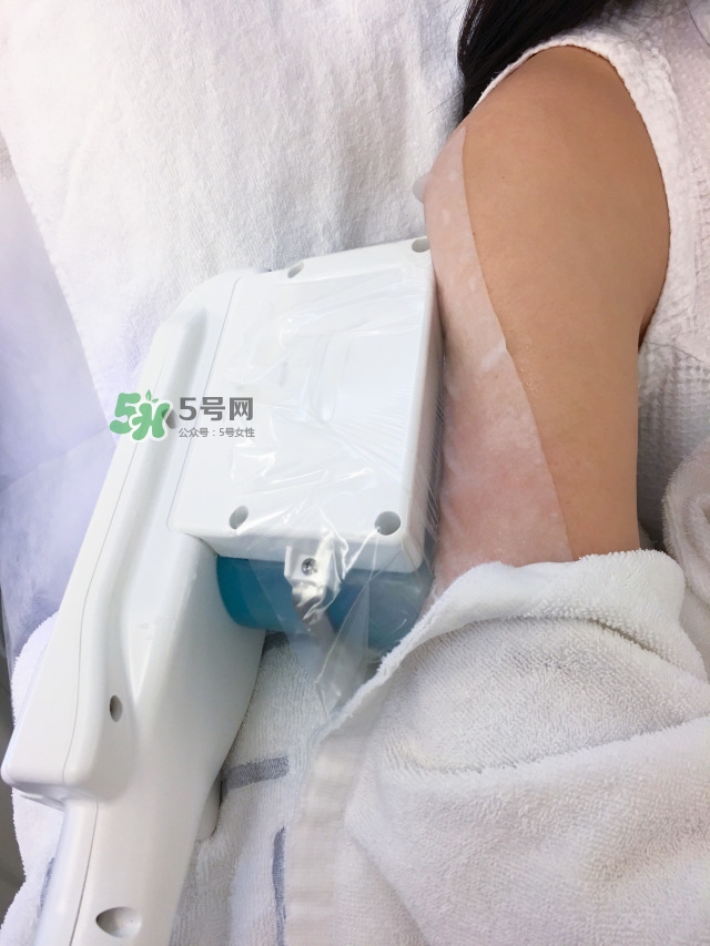 酷塑溶脂效果對比圖片 酷塑溶脂全過程記錄 酷塑溶脂效果對比圖片 酷塑溶脂全過程記錄