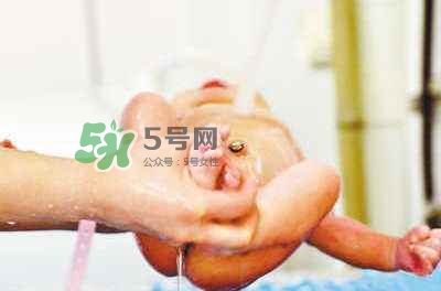 羊水栓塞是醫(yī)療事故嗎？羊水栓塞多發(fā)生于順產(chǎn)還是剖腹產(chǎn)？