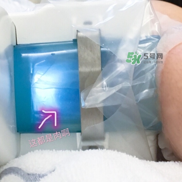 酷塑溶脂效果對比圖片 酷塑溶脂全過程記錄 酷塑溶脂效果對比圖片 酷塑溶脂全過程記錄