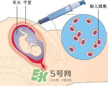 羊水栓塞是怎么回事？羊水栓塞怎么預(yù)防？