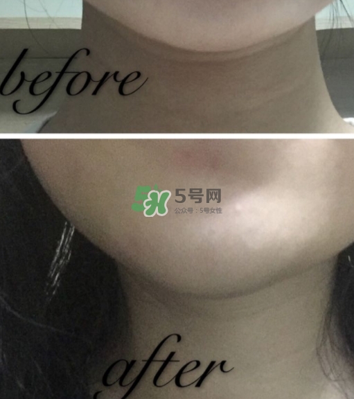 olay小白瓶有哪些版本？olay小白瓶版本區(qū)別