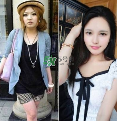 周揚(yáng)青在哪里整容的？周揚(yáng)青整容整了哪里？