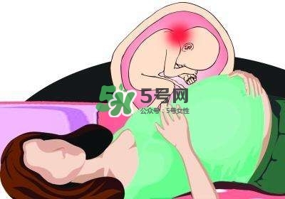 孕婦左側(cè)臥睡不著怎么辦？孕期左側(cè)睡不舒服怎么辦？