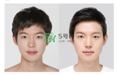 美白針有副作用嗎？美白針有什么副作用？