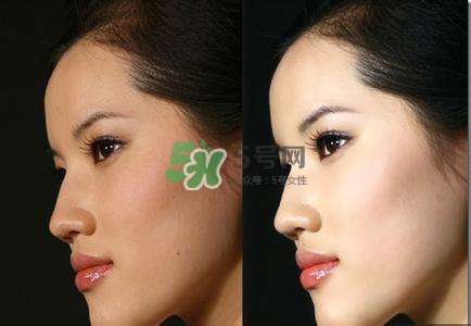 美白針有副作用嗎？美白針有什么副作用？