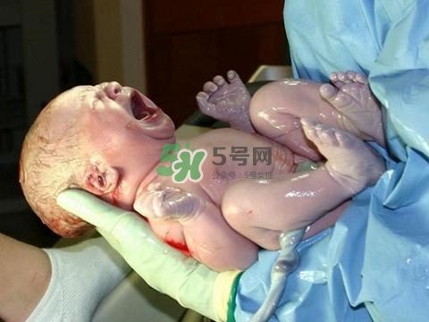 順產(chǎn)有多疼？順產(chǎn)的疼痛可以忍受嗎？